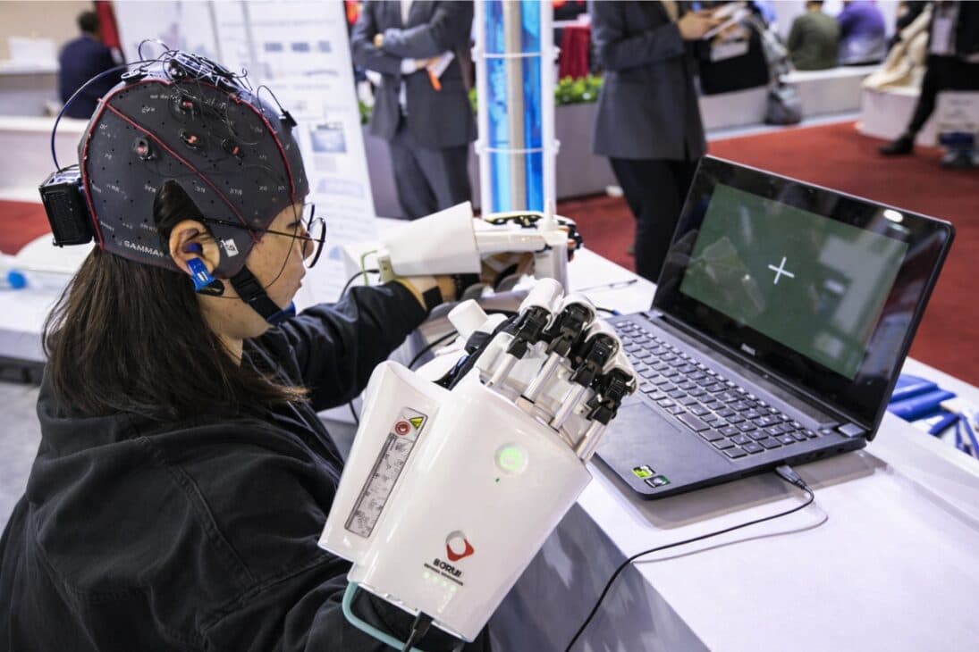 China aprova primeiro implante cerebral para ajudar pacientes com paralisia